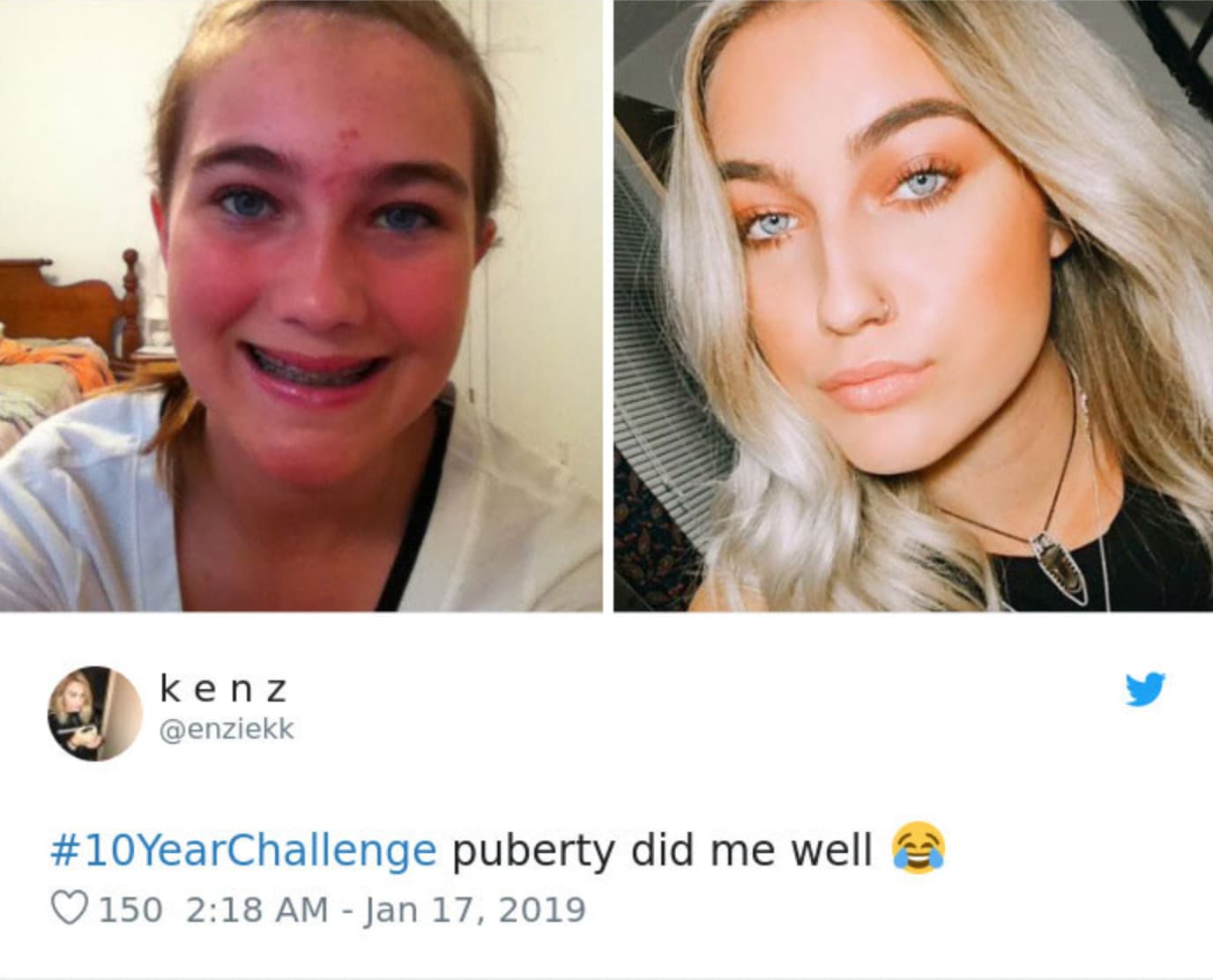 girl - kenz YearChallenge puberty did me well 150